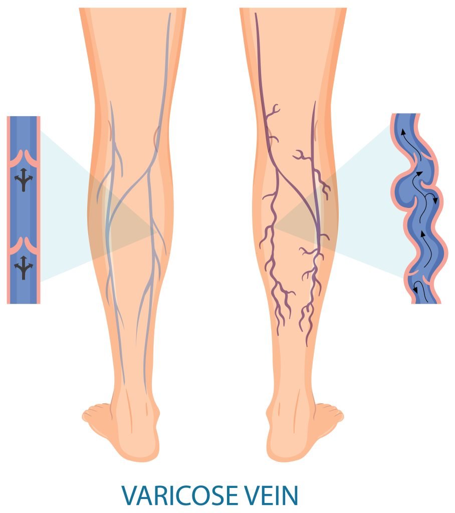 Angiolaser Clínica de Angiologia e Cirurgia Vascular Araguaína TO